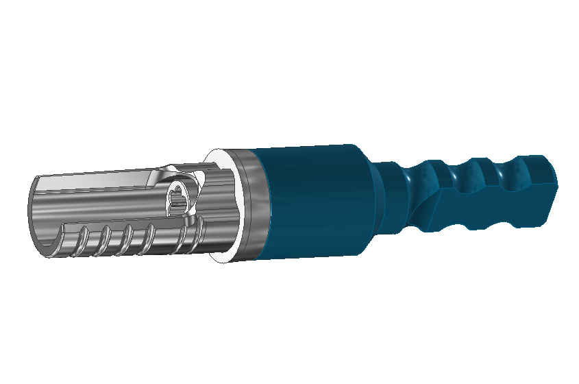 Custom Dental Implant
