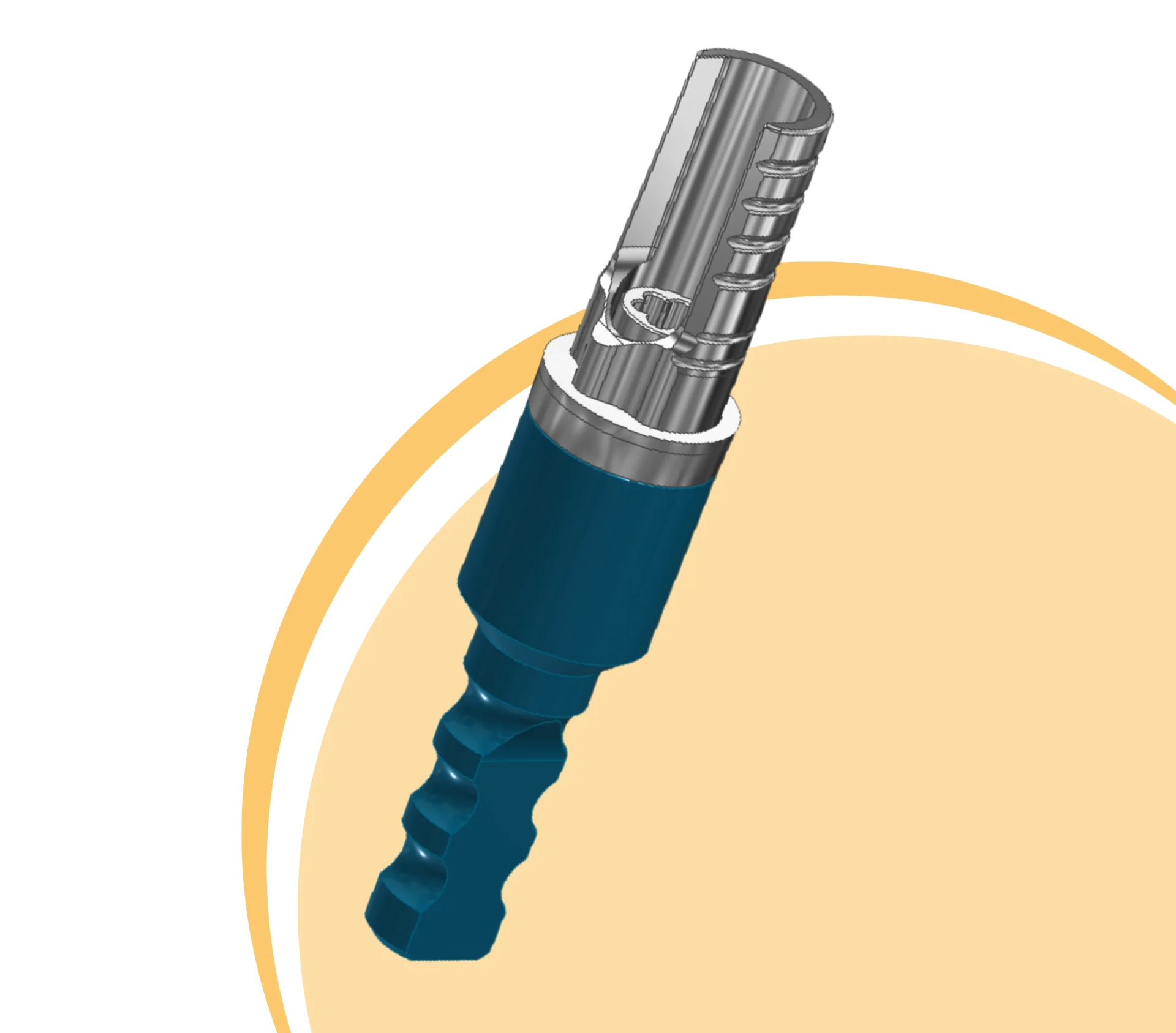 Custom Dental Implant